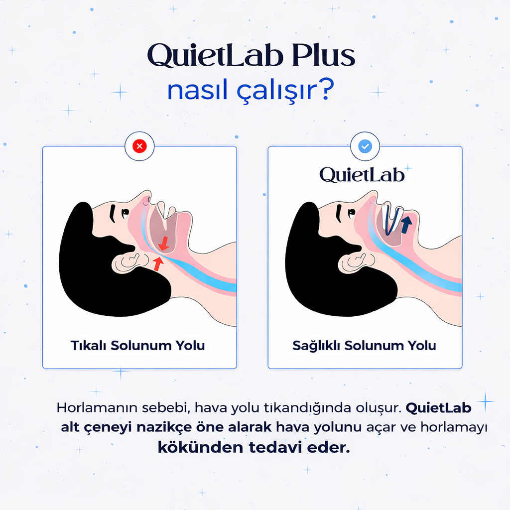 QuietLab® Horlama Önleyici Ağızlık